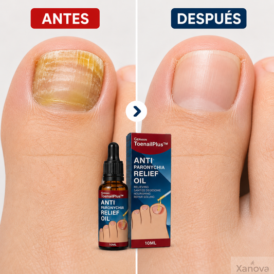 Anti Hongo Toenailplus Elimina Hongos